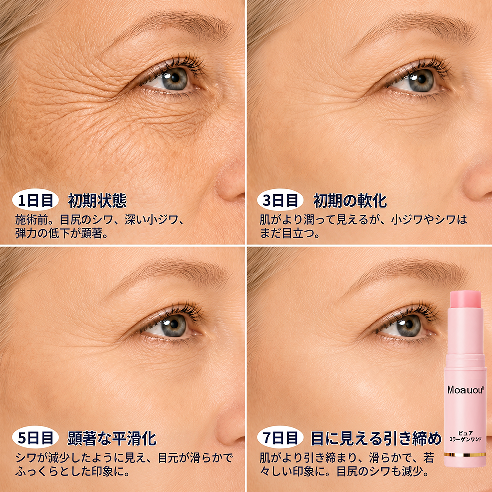 日本🌸𝐌𝐨𝐚𝐮𝐨𝐮® ボトックス発想 純粋コラーゲン引き締めスティック——針を使わずに、細かいシワをなめらかに整え、ハリ・弾力・ふっくら感を与えるエイジングケアバーム