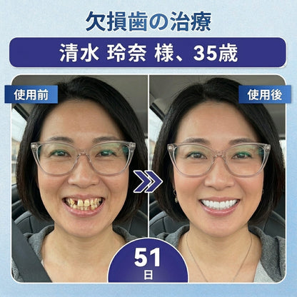 🇯🇵🦷知覚過敏・歯ぐきの不快感をしっかりケア！ 𝐂𝐨𝐚𝐮𝐨𝐨® タイドグルシブ配合オーラルストリップが登場。 歯と歯ぐきを優しく速やかに整え、貼るだけ簡単ケア。 毎日の口内ケアを無理なくグレードアップ✨