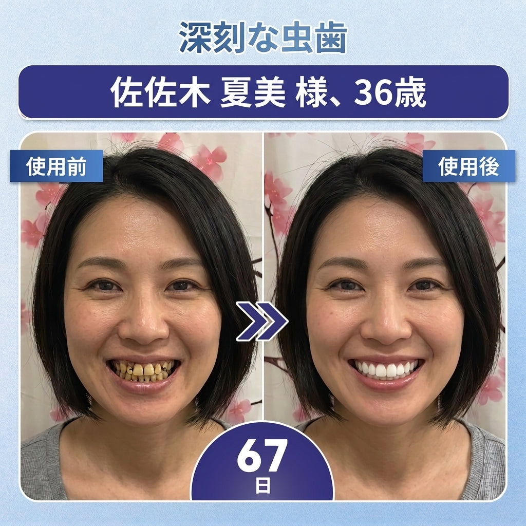 🇯🇵🦷知覚過敏・歯ぐきの不快感をしっかりケア！ 𝐂𝐨𝐚𝐮𝐨𝐨® タイドグルシブ配合オーラルストリップが登場。 歯と歯ぐきを優しく速やかに整え、貼るだけ簡単ケア。 毎日の口内ケアを無理なくグレードアップ✨